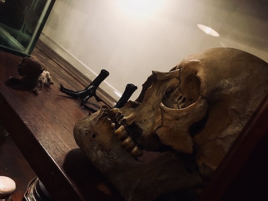 In-game: a closeup of a human skull.